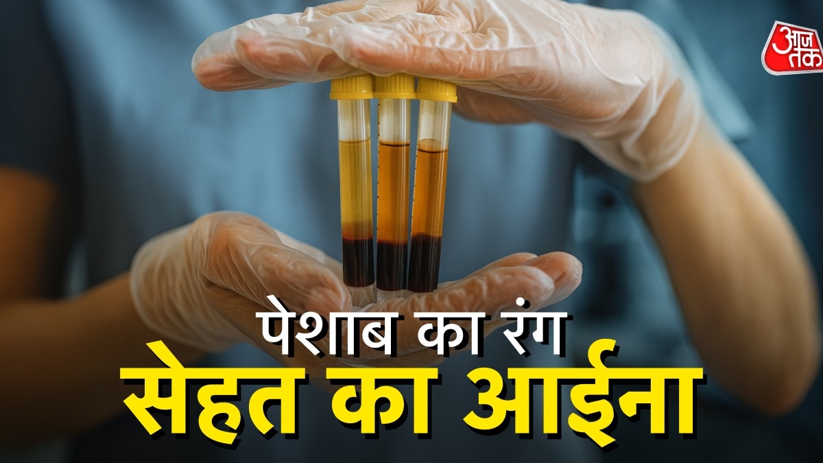 पेशाब का रंग अगर ज्यादा पीला या भूरा हो तो आपको किडनी स्टोन का खतरा हो सकता है. (Photo: ITG)