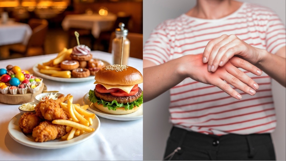 शरीर में सूजन बढ़ाते हैं ये फूड्स (Photo: AI generated/Freepik)