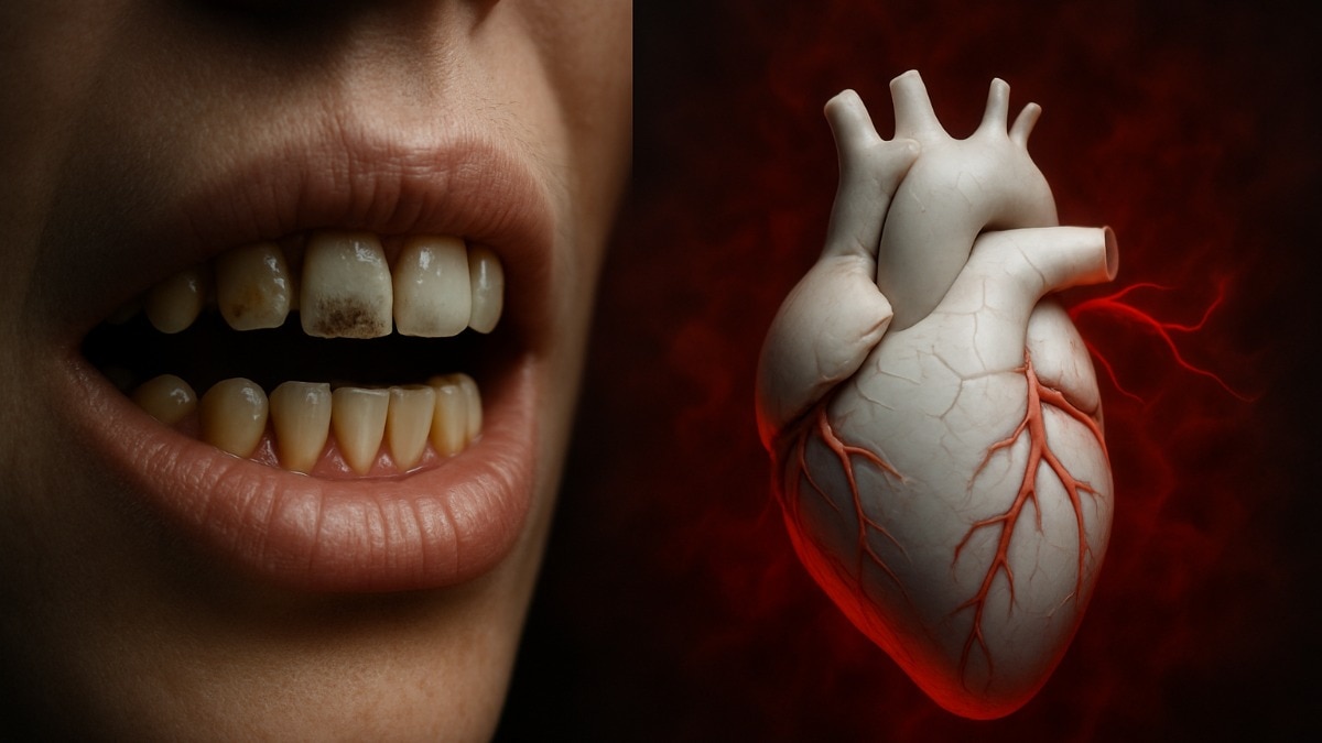 मुंह कै बैक्टीरिया हार्ट अटैक का कारण बन सकते हैं. (Photo: AI Generated)