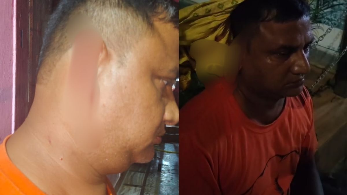 कानपुर में पत्नी कुतर गई आधा कान, थाने पहुंचा पति (Photo: ITG)