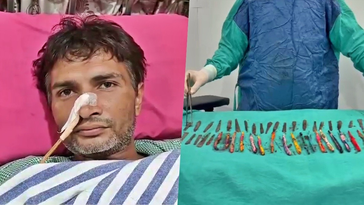 हापुड़ में मरीज के पेट से निकले चम्मच-टूथब्रश और पेन (Photo- ITG)