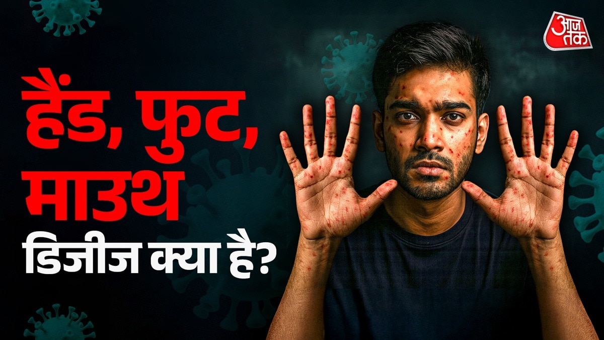 हैंड-फुट-माउथ बच्चों के साथ-साथ वयस्कों को भी प्रभावित कर रहा है. (Photo: AI Generated)