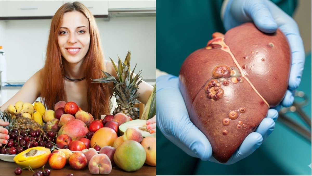 अधिक मात्रा में फल खाना खतरनाक (Photo: AI generated)