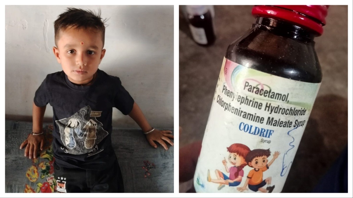 बैतूल: कफ सिरप पीने से वेंटिलेटर पर मासूम, दोनों किडनी फेल, प्रवीण सोनी ने लिखी थी दवाई – betul child cough syrup kidney failure ventilator lclnt