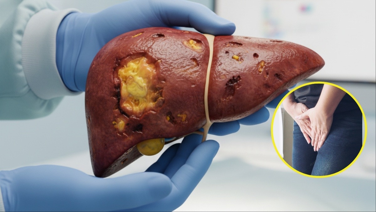 लिवर डैमेज होने के संकेत (Photo: AI generated)