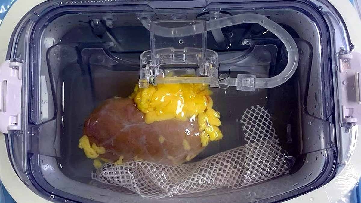 ये है वो यूनिवर्सल किडनी जिसे वैज्ञानिकों ने बनाया है. (Photo: Zeng et al Natura Biomedical Engineering)