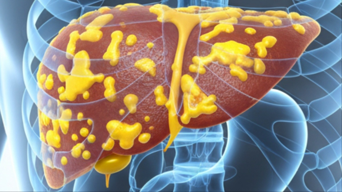 Liver Health: लिवर की सारी गंदगी हो जाएगी साफ, बस आजमाएं ये देसी तरीका