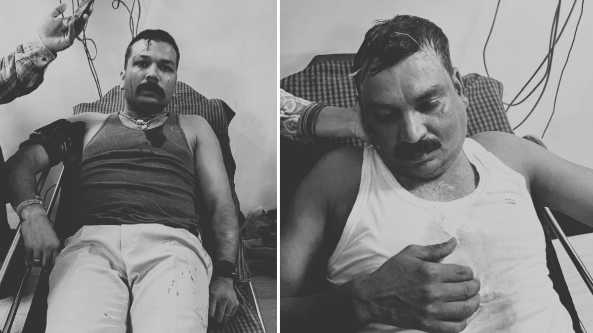 हमले में थाना प्रभारी और कांस्टेबल घायल (Photo: Ravish Pal Singh/ITG)