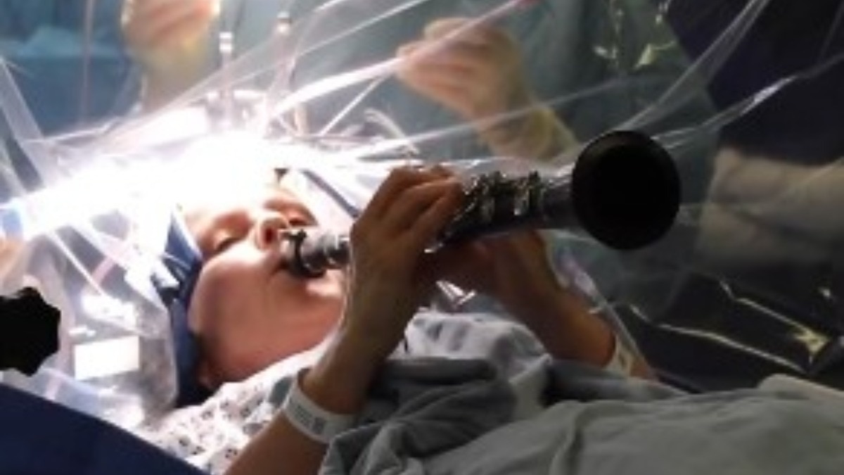 woman-plays-clarinet-during-brain-surgery-in-london-video-viral