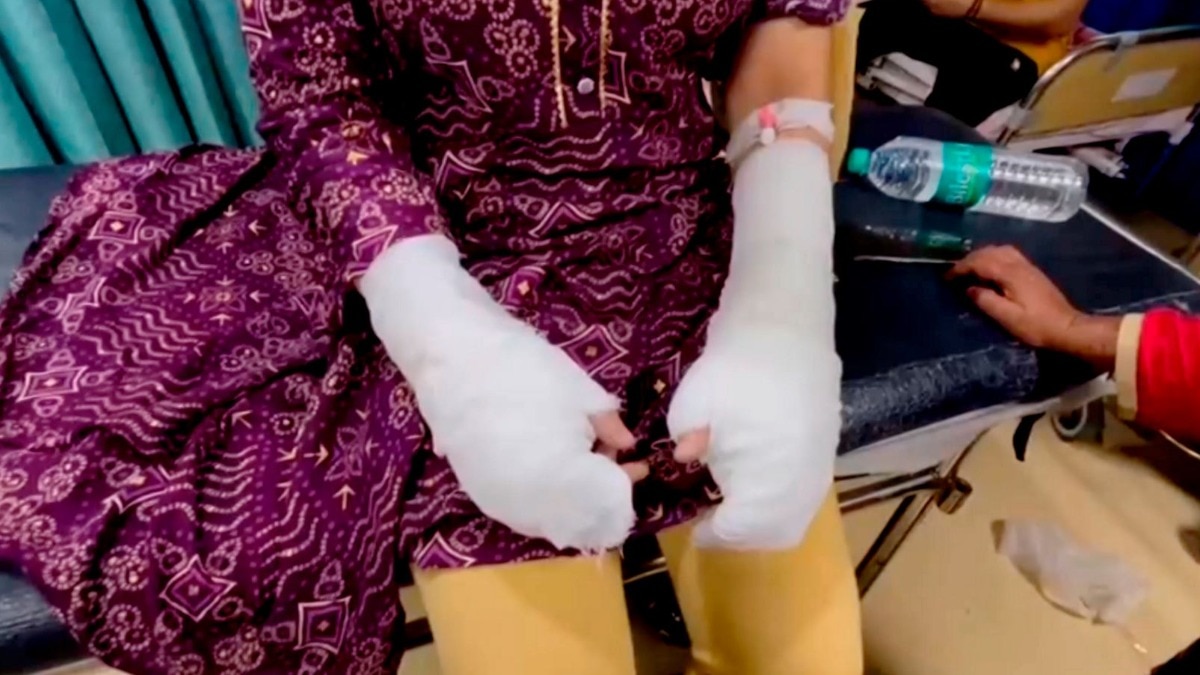 Delhi Acid Attack Case