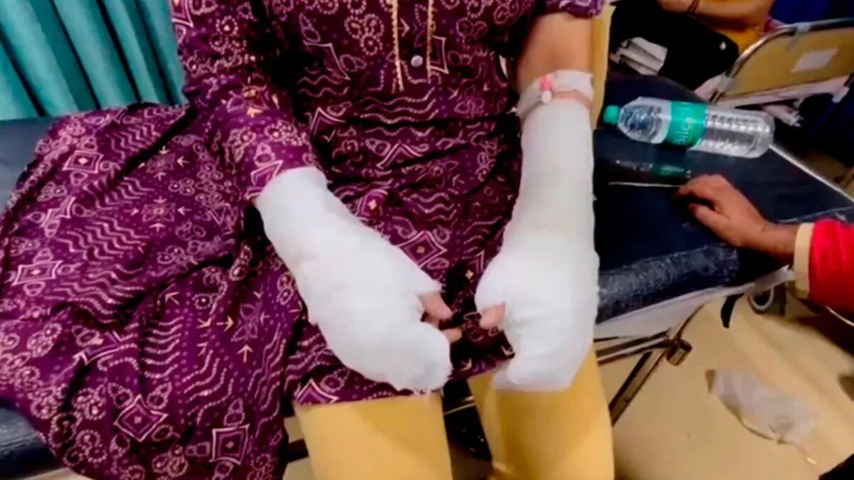 छात्रा ने खुद ही अपने ऊपर डाला था 'एसिड', CCTV से खुली पोल... दिल्ली कांड की पूरी क्रोनोलॉजी