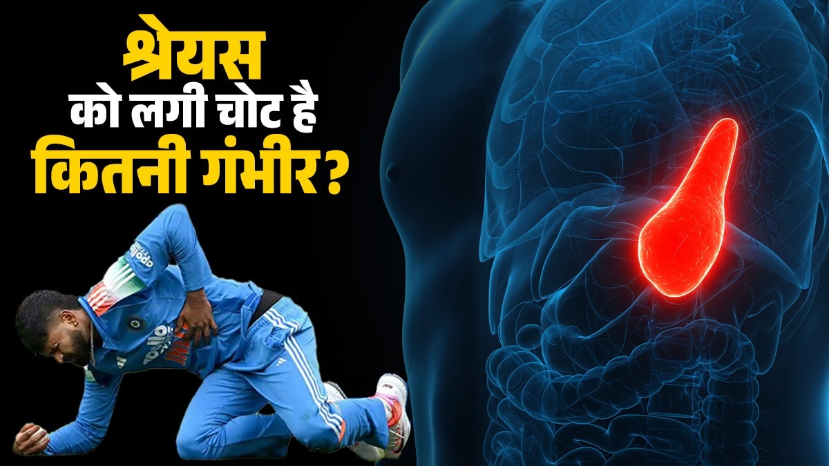 Shreyas Iyer suffers Injury: श्रेयस की 'तिल्ली' में लगी चोट कितनी खतरनाक? फैन्स का एक ही सवाल.. मैदान पर वापसी कब