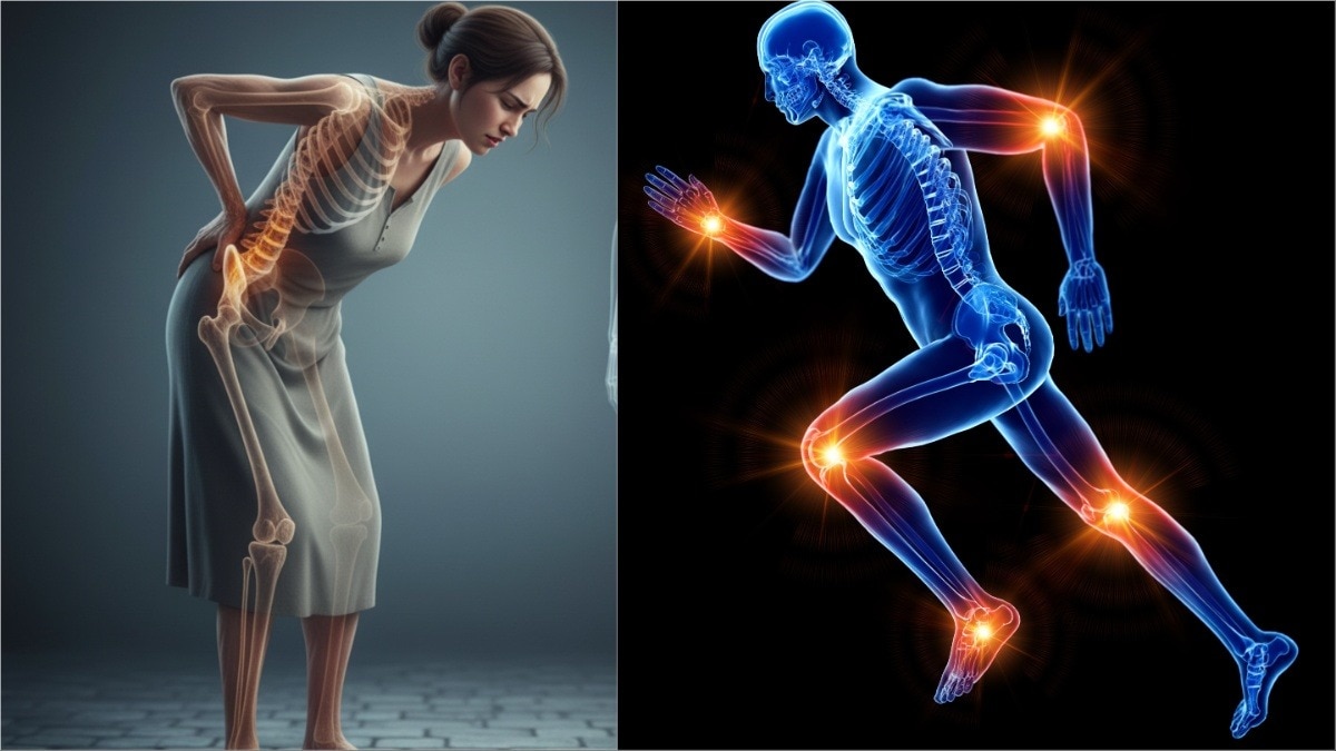 हड्डियों को मजबूत बनाने के लिए क्या खाएं (Photo: AI generated/getty)