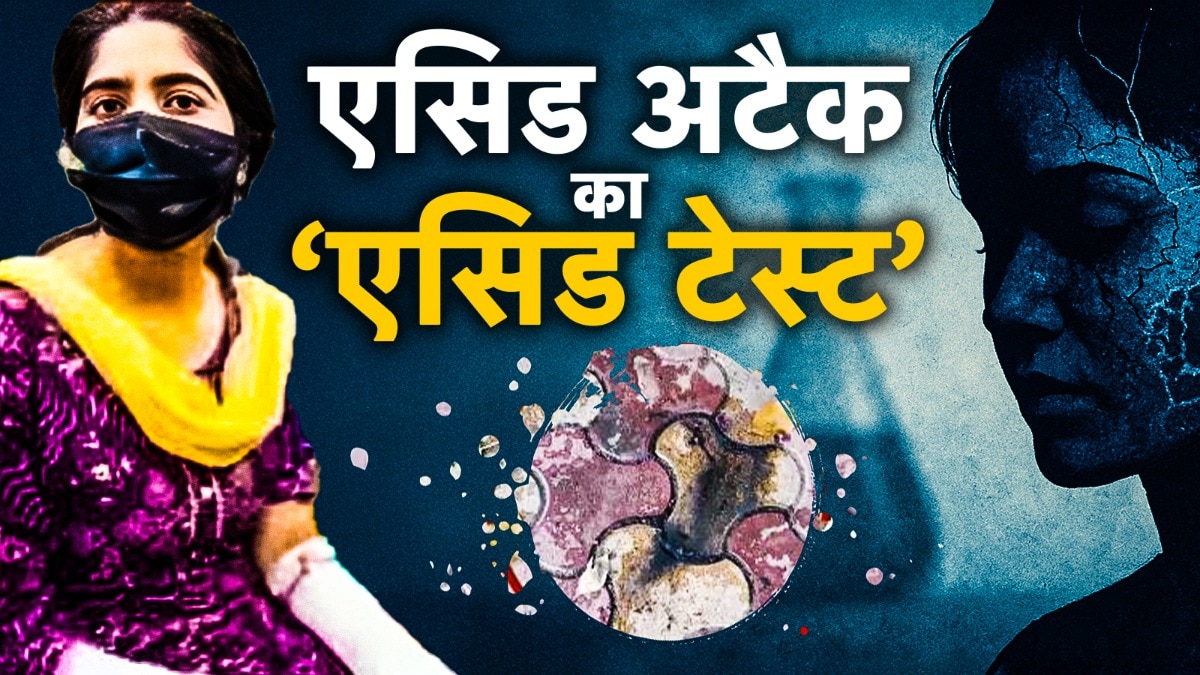 दिल्ली भरत नगर में में बाप-बेटी ने रचा फेक एसिड अटैक का खौफनाक ड्रामा. (Photo: ITG)