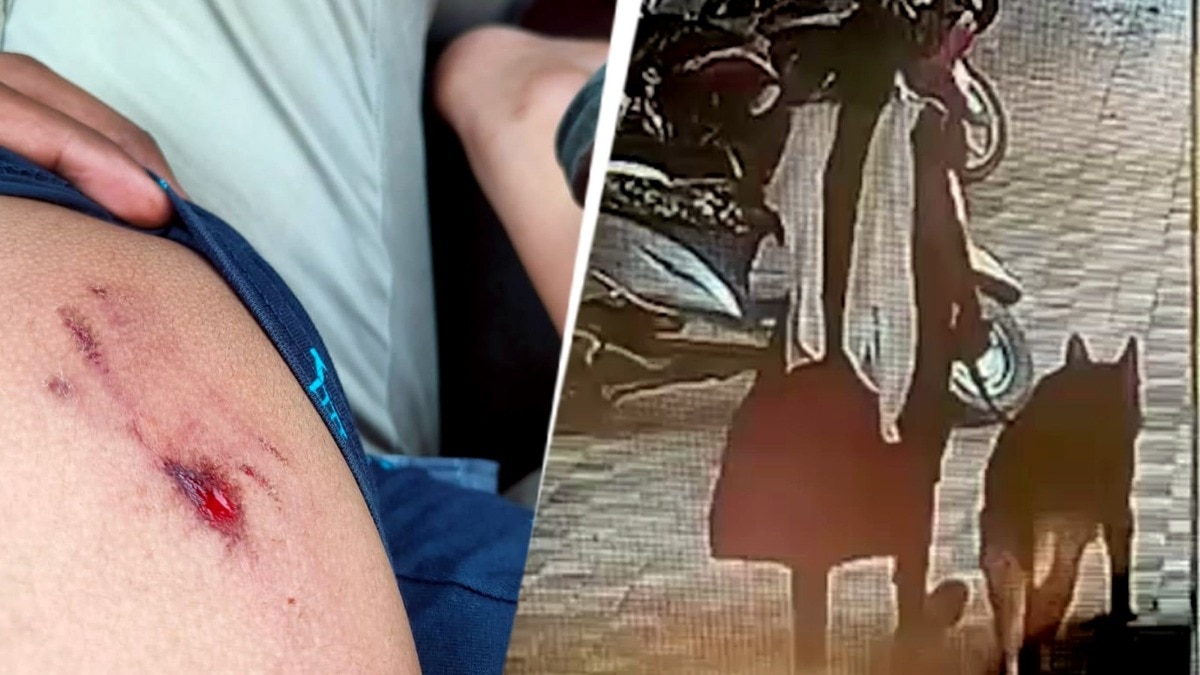 6 year boy was bitten by a German Shepherd