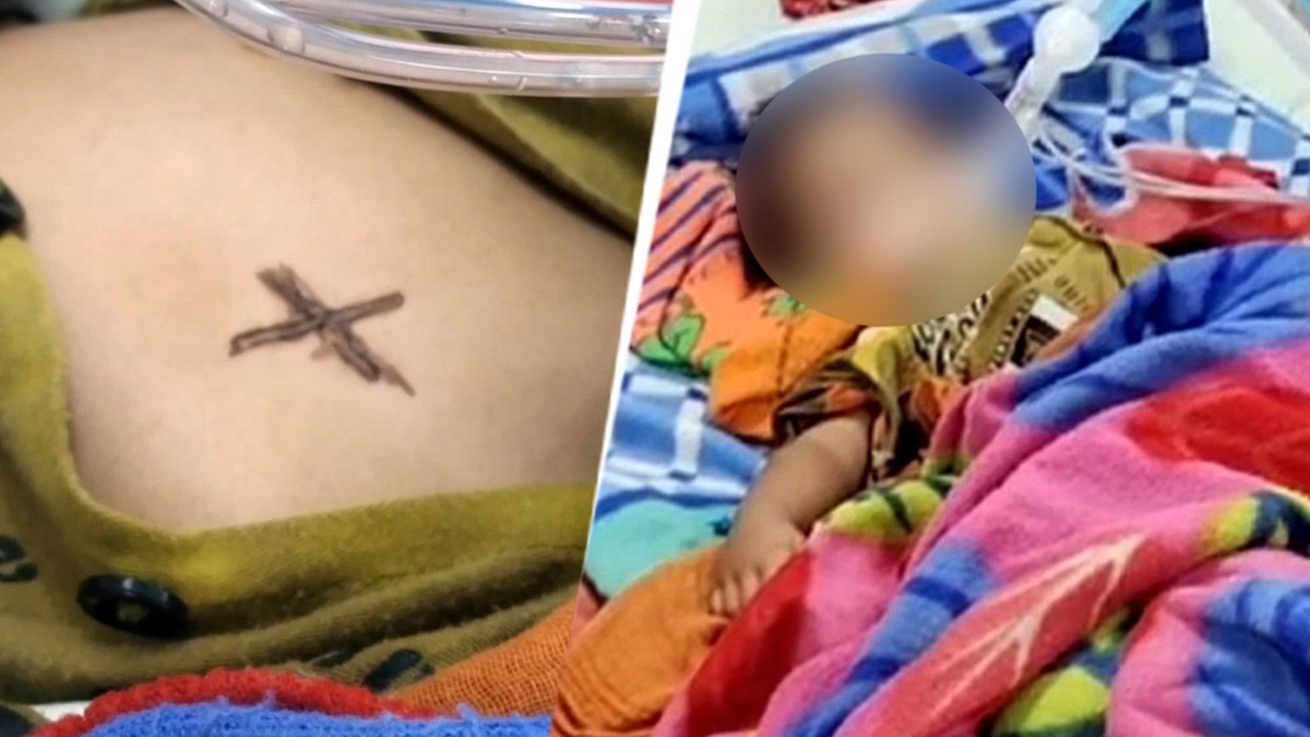 Rajasthan Innocent Child Burnt with Hot Iron Rods 