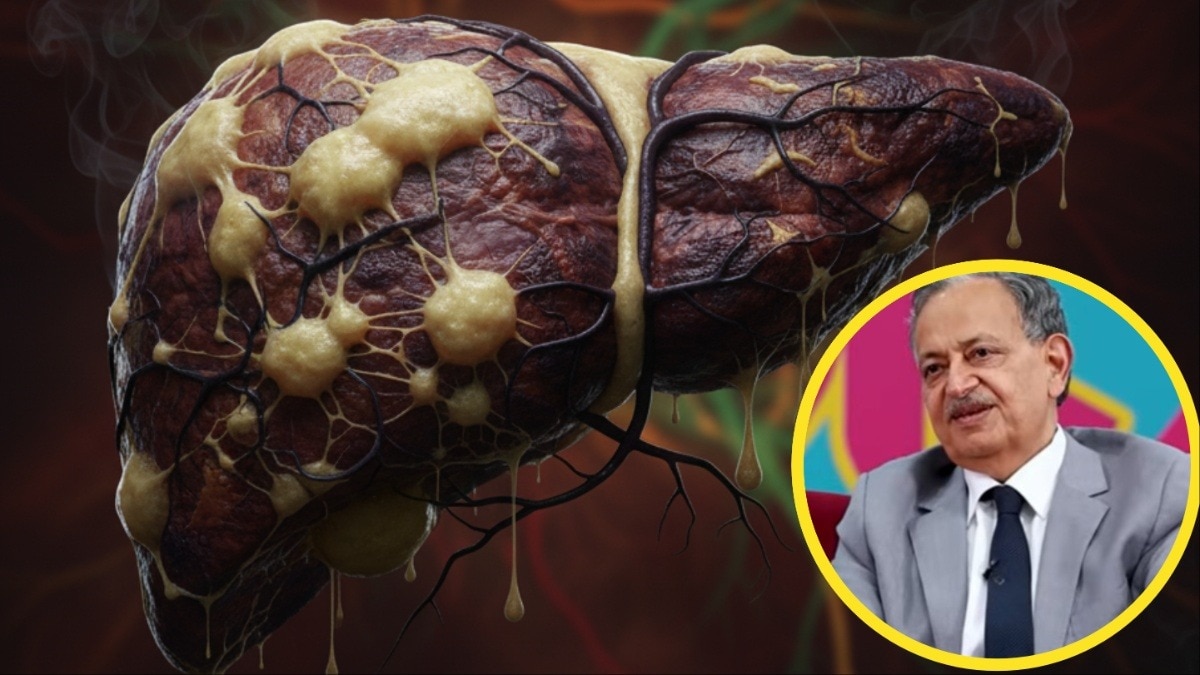 Liver Health: लिवर के लिए खाएं ये चीजें... दूर भागेगा Fatty Liver, डॉक्टर सरीन ने बताया
