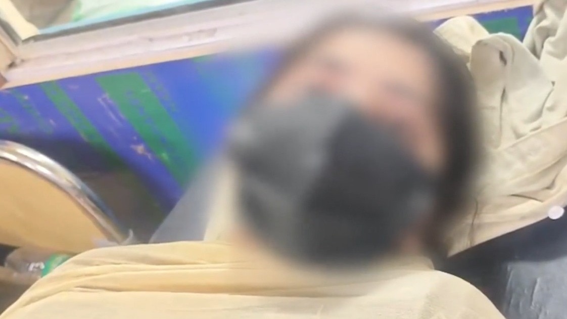 ग्वालियर: महिला से शादी करना चाहता था जेठ, मना किया तो कर दिया एसिड अटैक