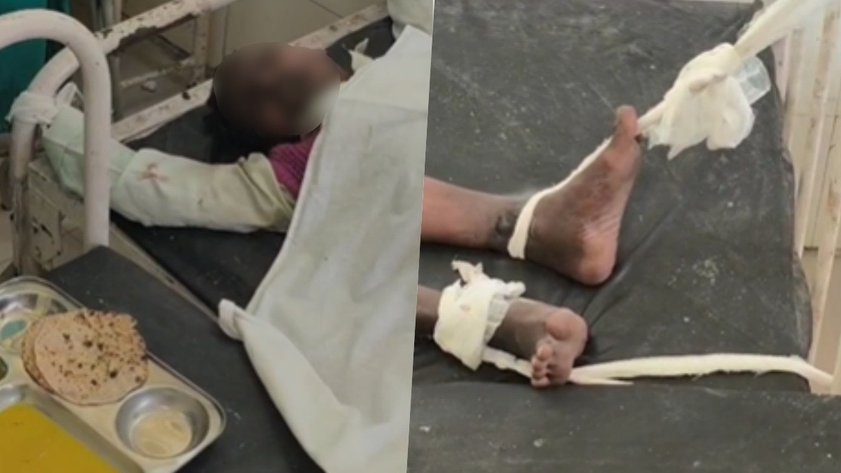 रोटी सामने... हाथ-पांव बंधे: अयोध्या जिला अस्पताल में मरीज के साथ अमानवीय व्यवहार; तोड़ा दम