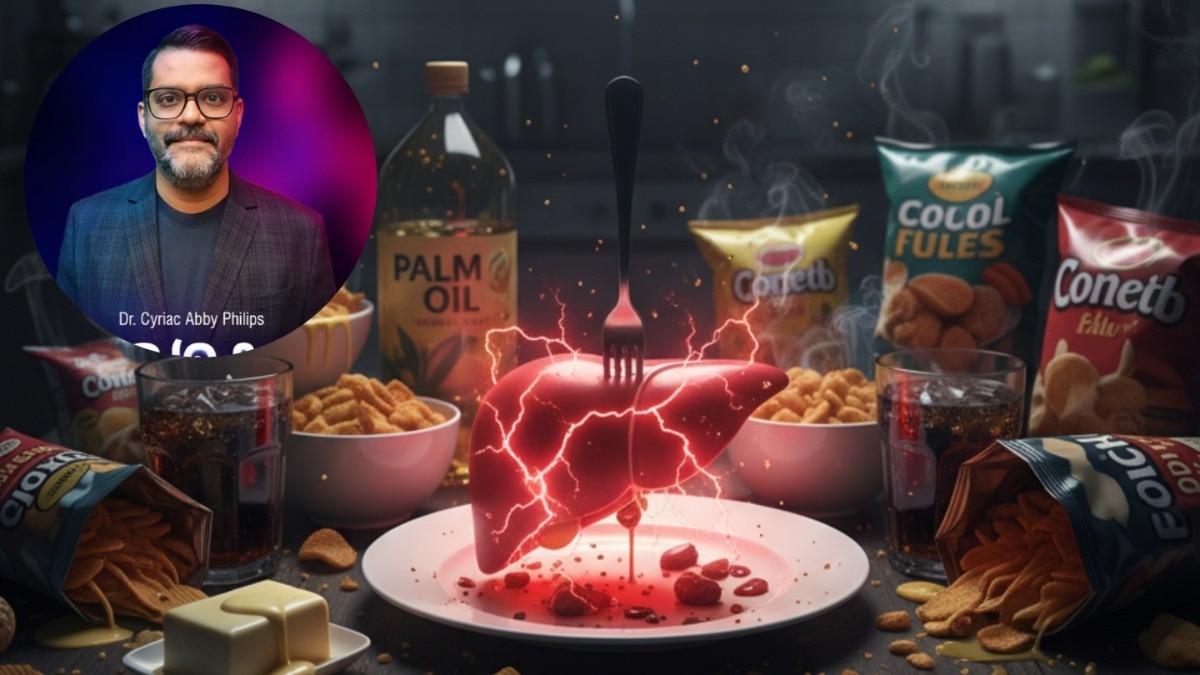 Unhealthy foods for liver (Photo: AI Generated/Instagram@theliverdr)