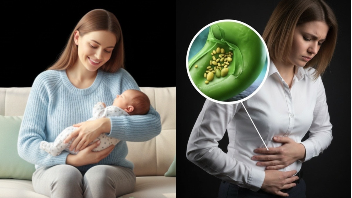 gallbladder stones postpartum women