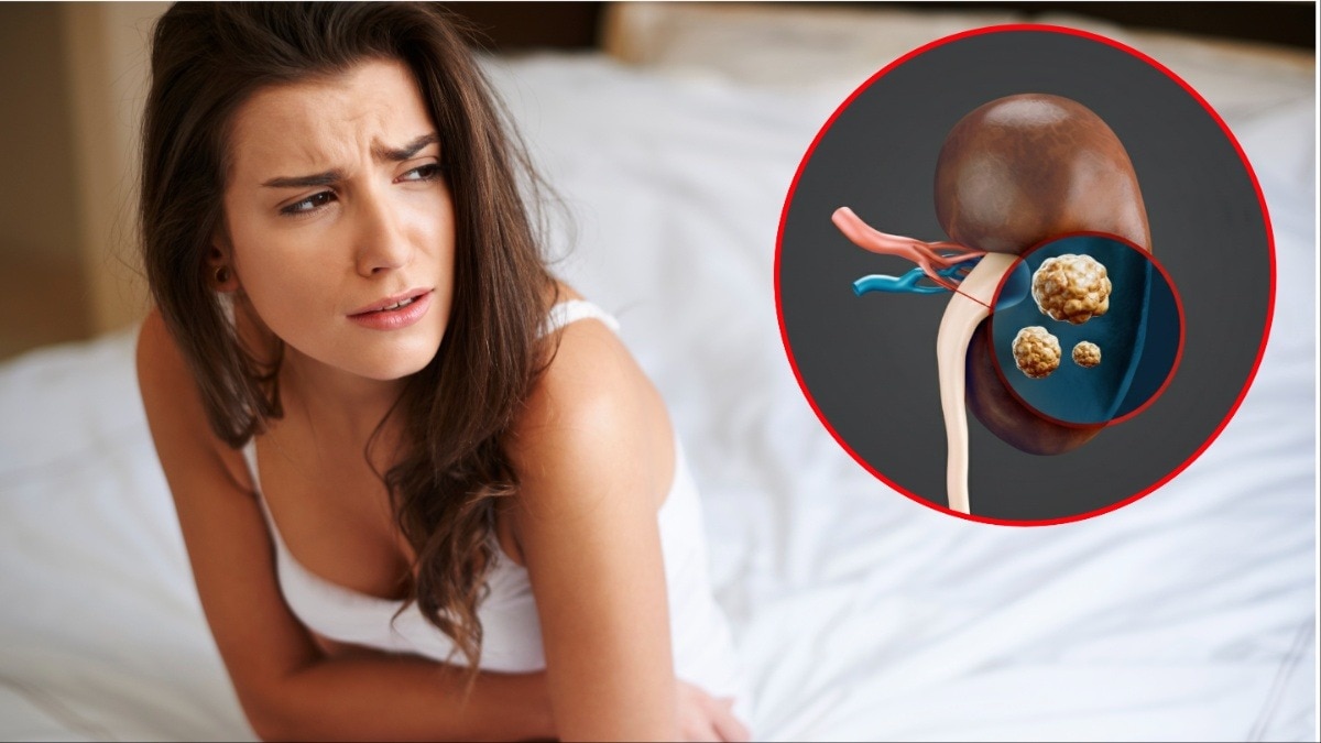 kidney stone vs period pain