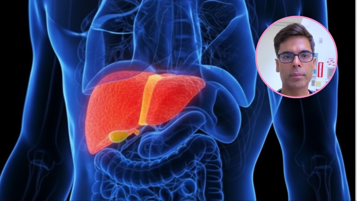  फैटी लिवर के शुरुआती लक्षण (Photo- Instagram@/Saurabh Sethi)