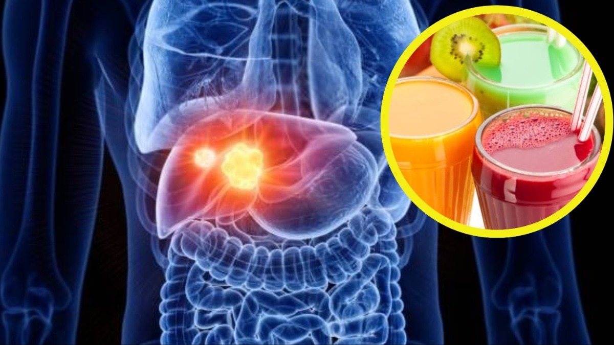 ये 5 ड्रिंक्स फैटी लिवर को दूर रखती हैं (Photo: Getty)