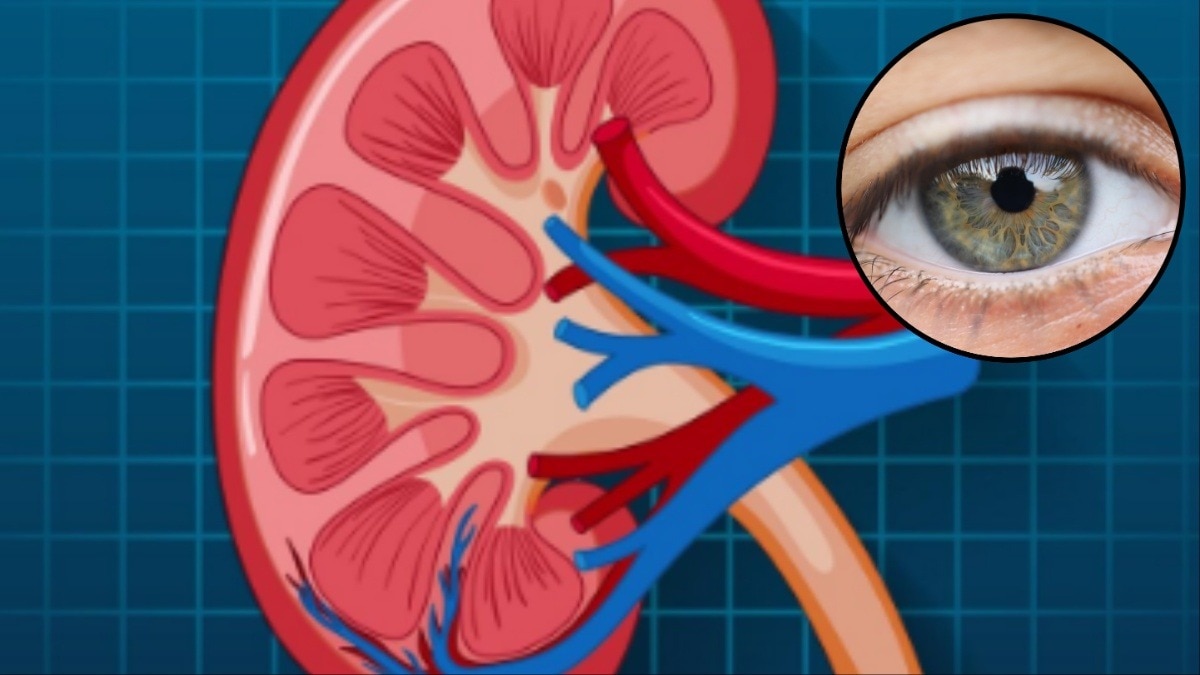 किडनी खराब होने पर आंखें देती हैं ये 4 संकेत (Photo- Freepik & Pixabay)