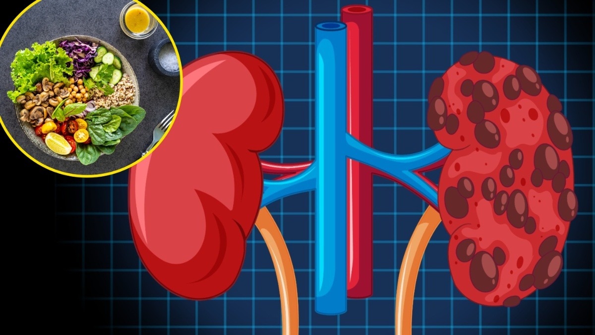 Kidney Damage from healthy foods (Photo: Freepik)