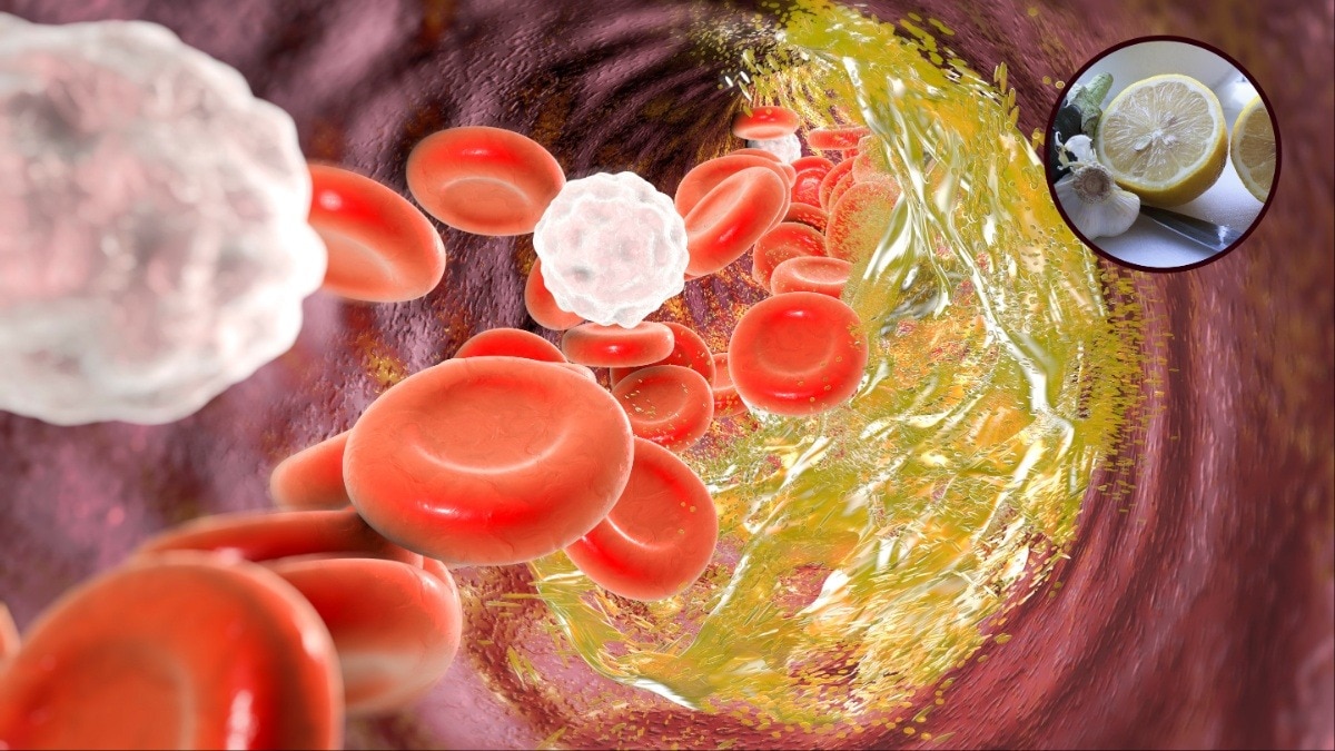 क्या नींबू पानी और लहसुन बैड कोलेस्ट्रॉल कम कर सकता है? (Photo- Getty image & Pixabay)