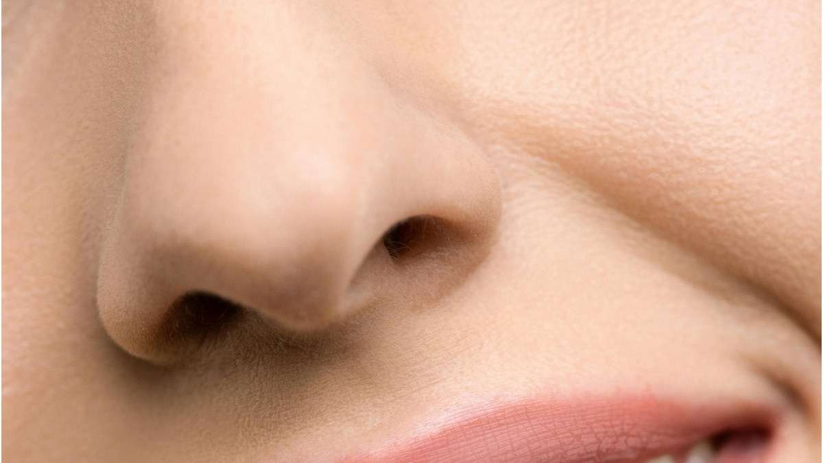 जन्म के वक्त ही महिला के नाक में फंसी थी ये चीज... 35 साल बाद ऐसे चला पता, फिर डॉक्टर ने निकाला