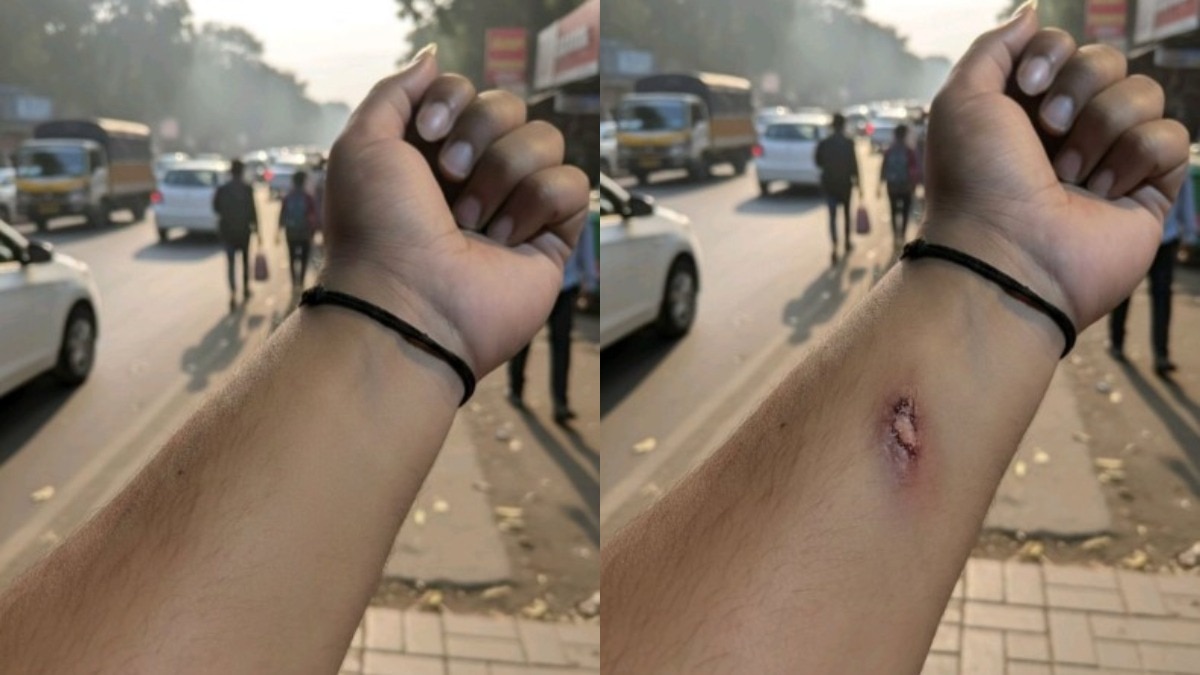 AI fake injury employee tricks HR, AI generated photo leave