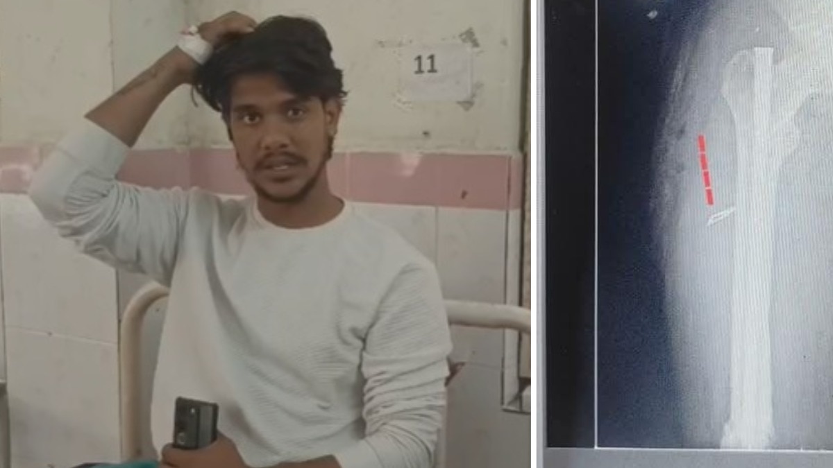 doctors left surgical blade.