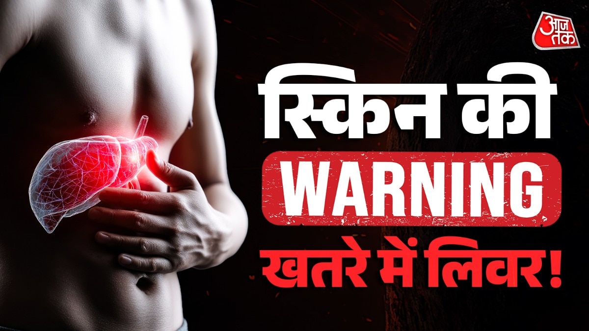 Liver Damage Symptoms On Skin (Photo: ITG)