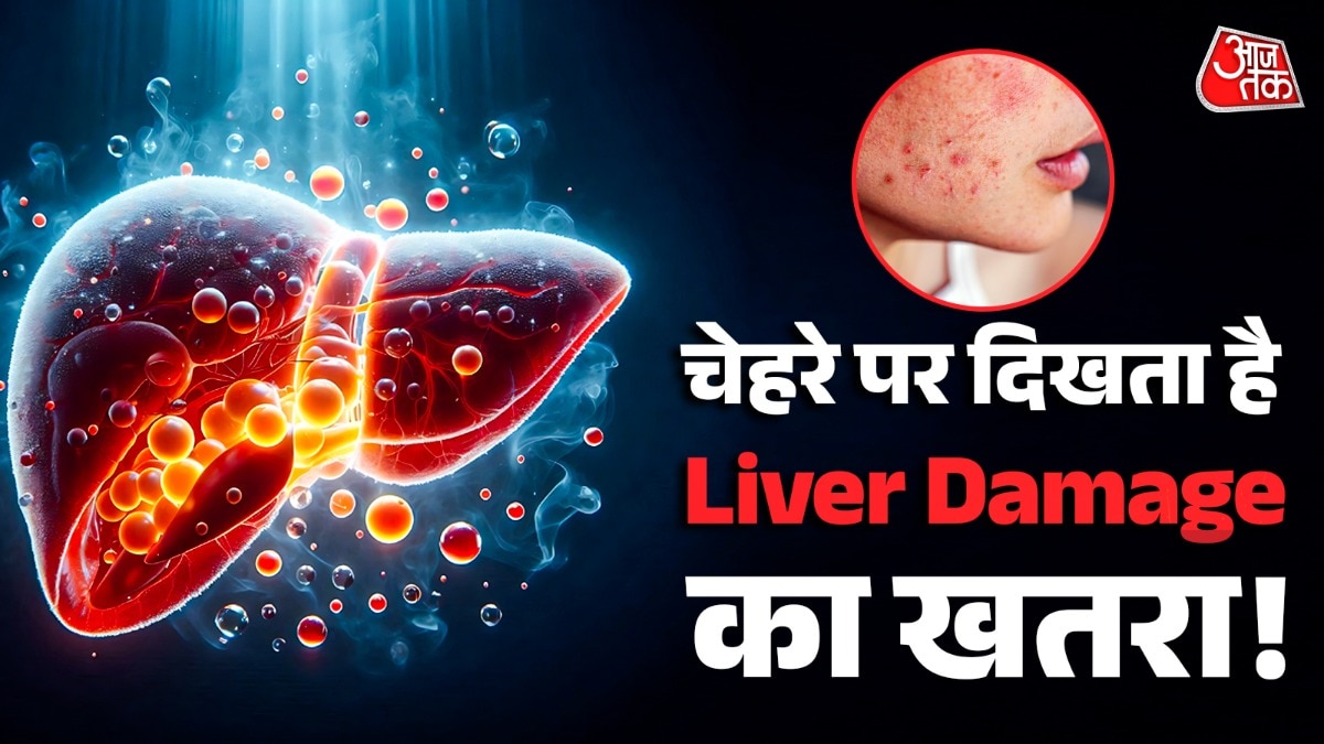 Fatty Liver Warning Signs (Photo: ITG)