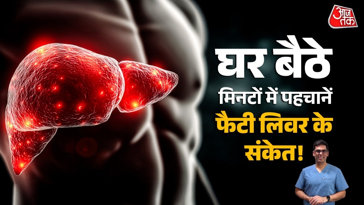 Fatty Liver (Photo: ITG)