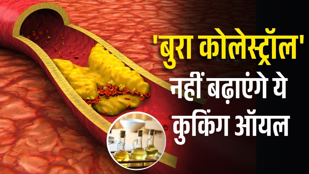 cooking Oils cholesterol