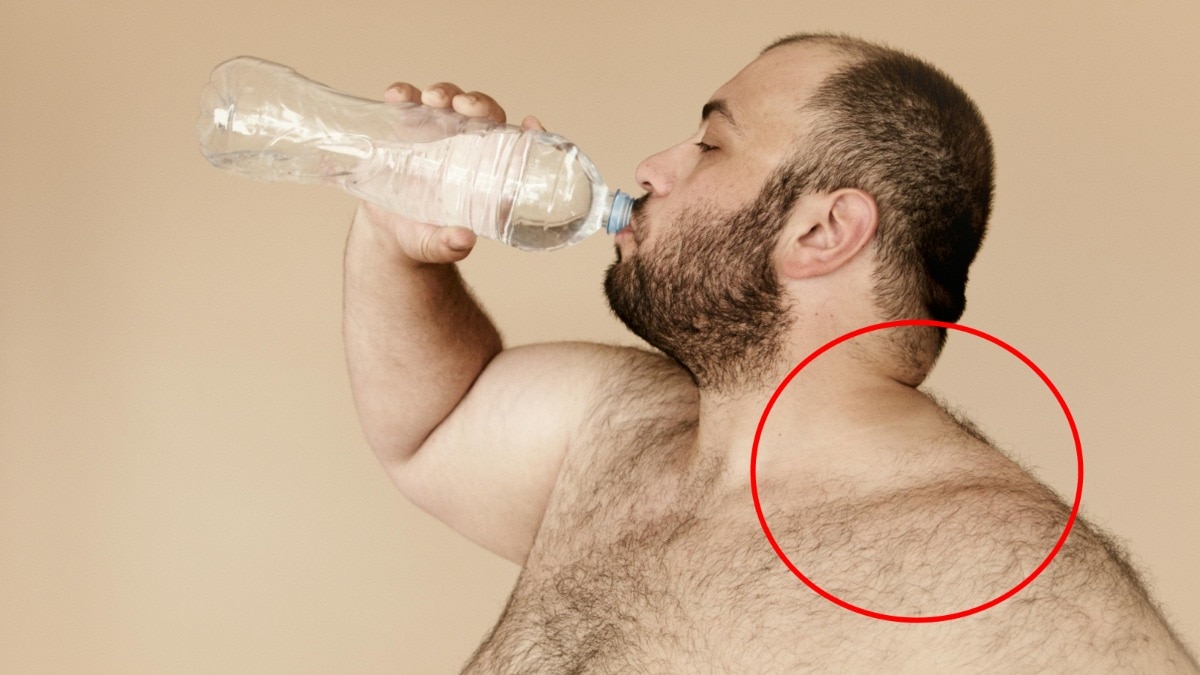 ब्राउन फैट कंधे और गर्दन के बीच पाया जाता है. (Photo: FreePic)