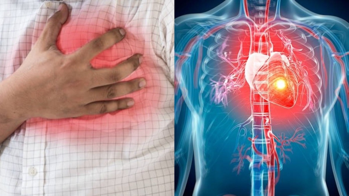 मिनी हार्ट अटैक और हार्ट अटैक में क्या अंतर है (Photo: Getty)