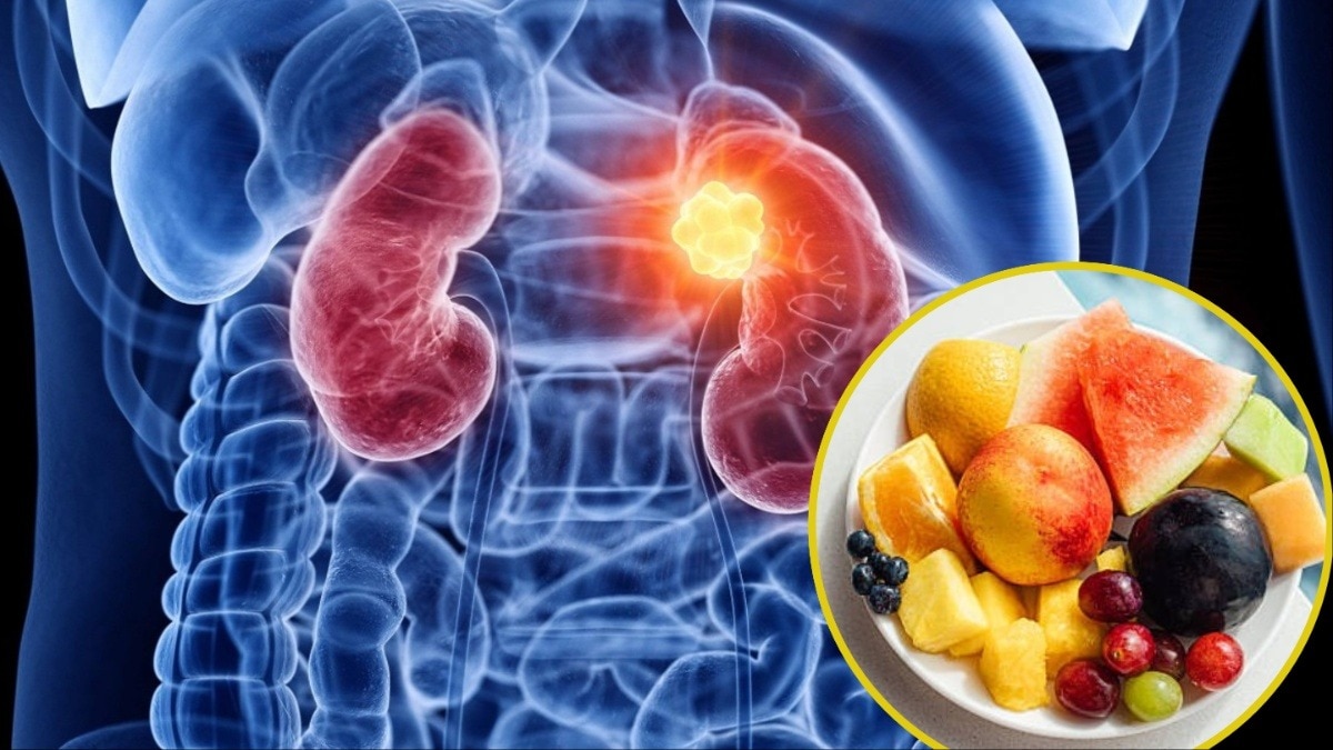 किडनी के लिए खाएं ये 3 फल (Photo: Getty)