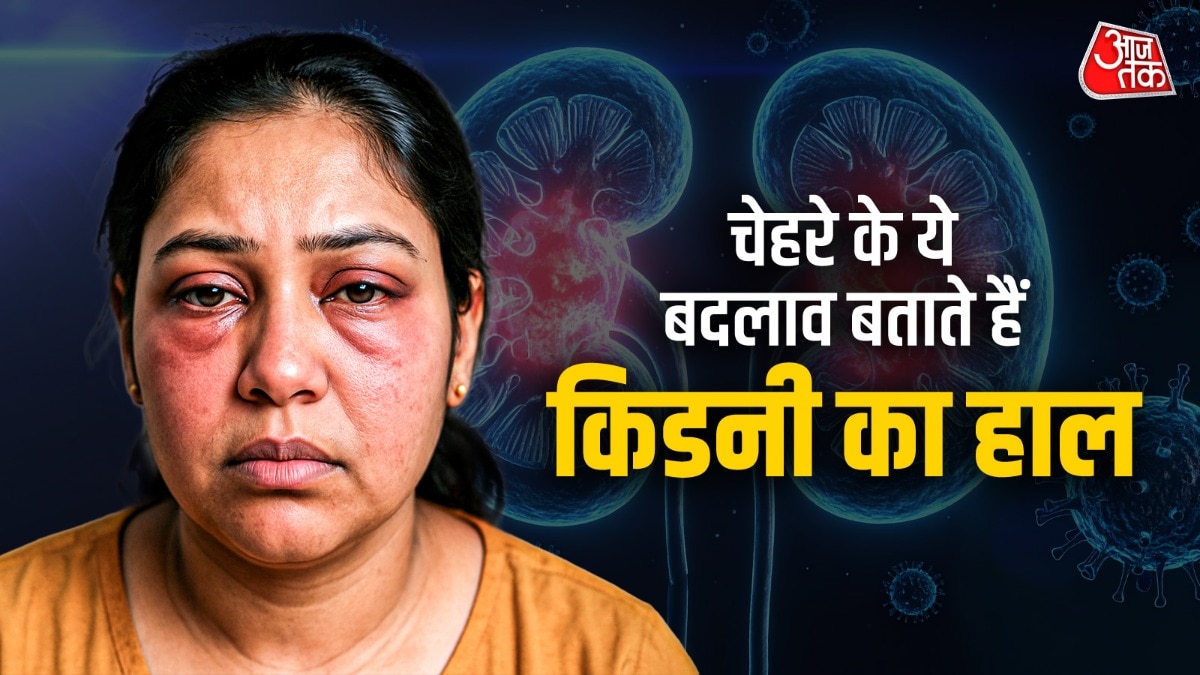 चेहरे पर दिखते हैं किडनी डैमेज के संकेत (Photo: ITG)