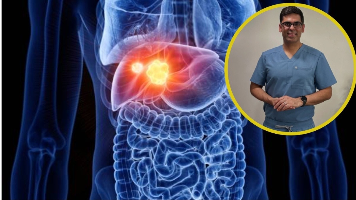 foods for fatty liver