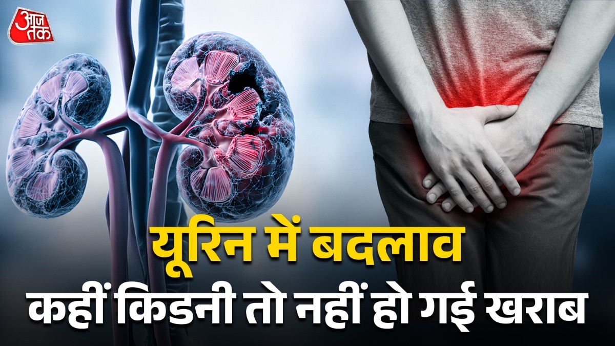 changes in urine indicate kidney failure