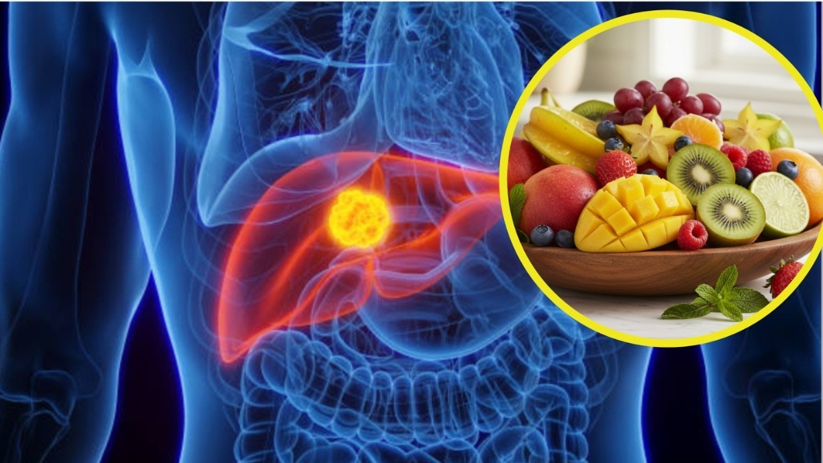 Foods for fatty liver