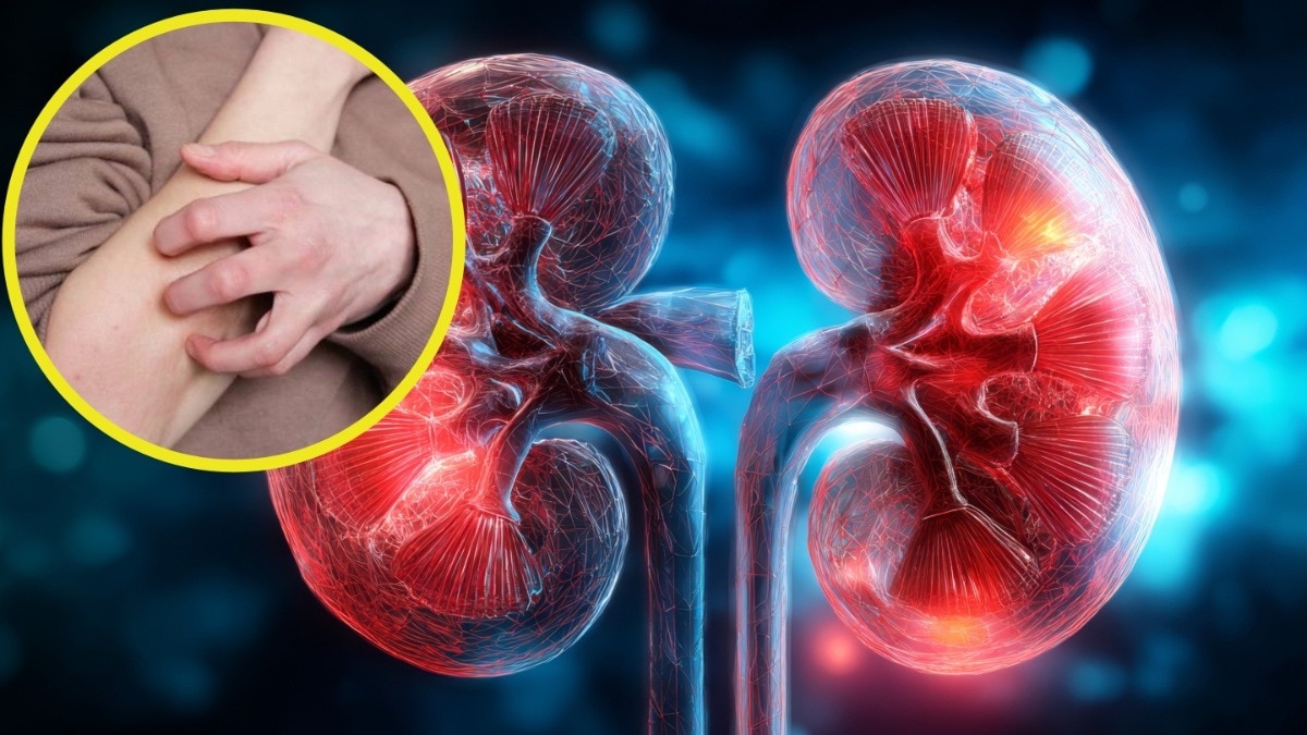 signs of Kidney damage 