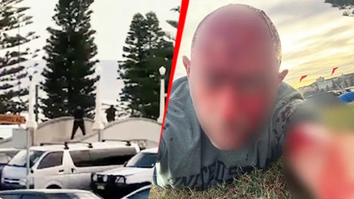 सिडनी अटैक में यहूदी नेता के सिर में लगी गोली, 7 अक्टूबर के हमास हमले में बाल-बाल बचे थे