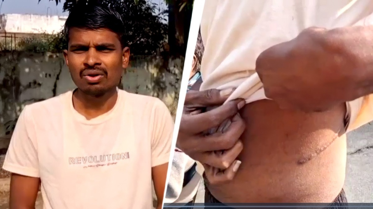 A case of a farmer selling his kidney to repay a loan