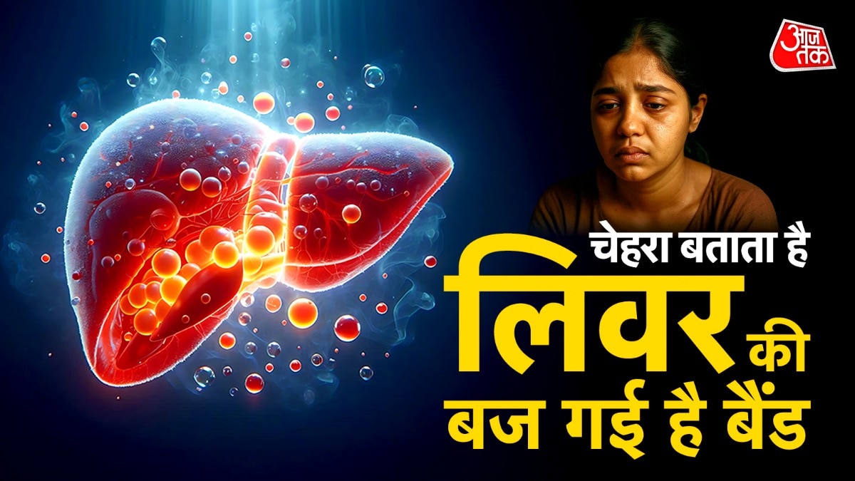 Liver damage symptoms on face