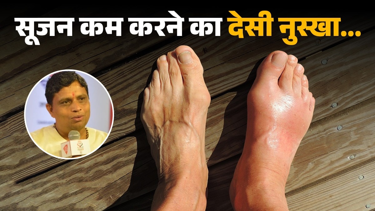 acharya balkrishna home remedy